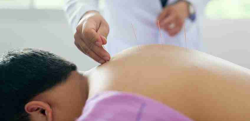 Acupuncture treatment at Gainesville Holistic Healthcare