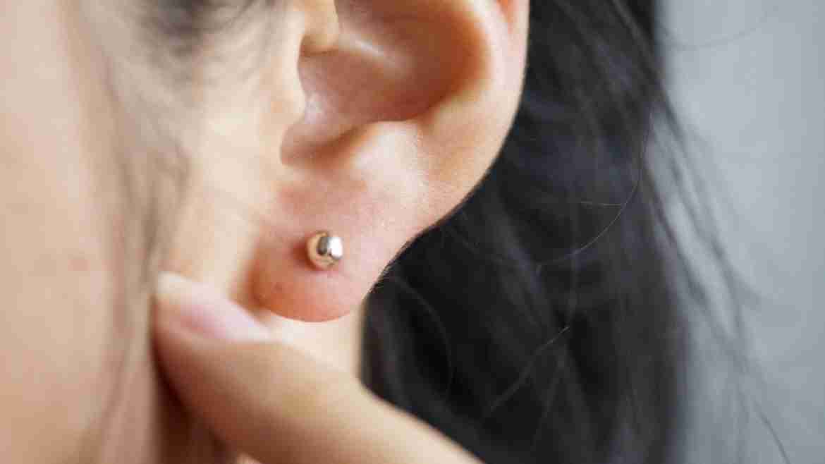 Tinnitus