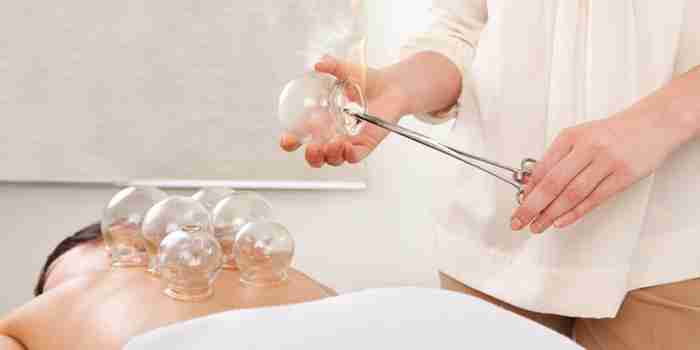 Cupping Therapy